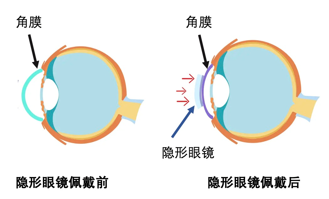 bde3649f8947e7fb891ae7287ebdc1fb.png