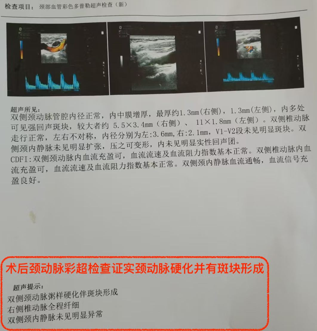 眼底出血，医生却让查血脂和颈动脉彩超？ - 广州普瑞眼科医院
