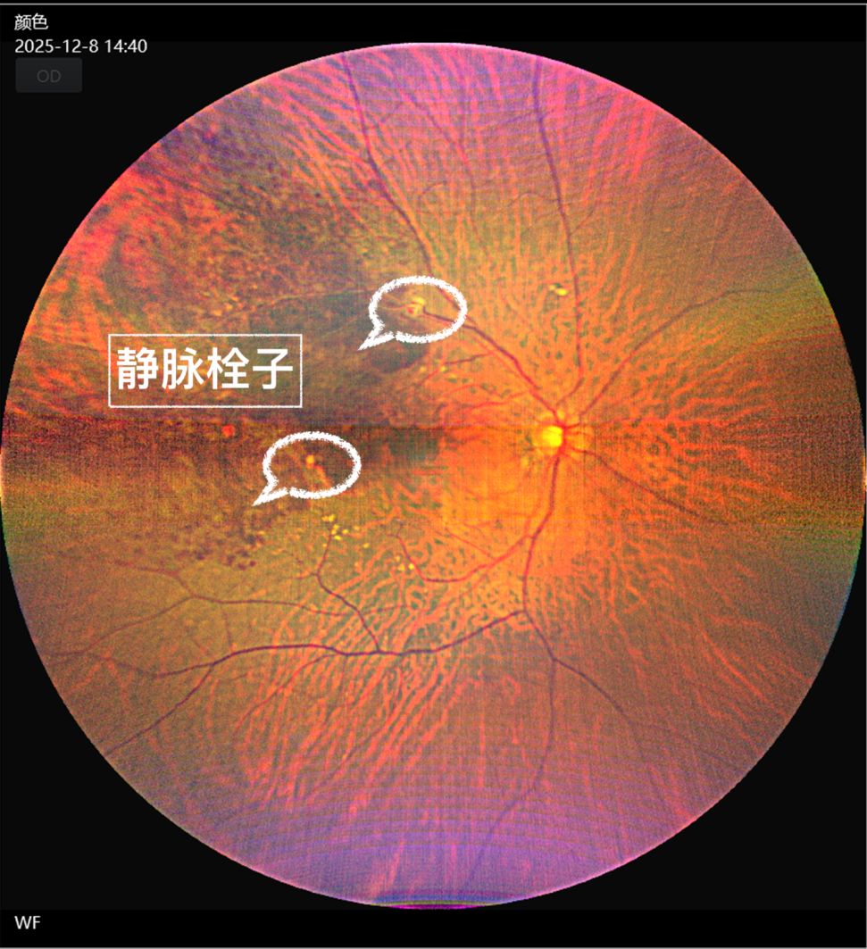 图1.png
