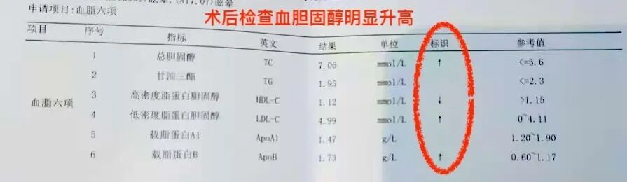 眼底出血，医生却让查血脂和颈动脉彩超？ - 广州普瑞眼科医院