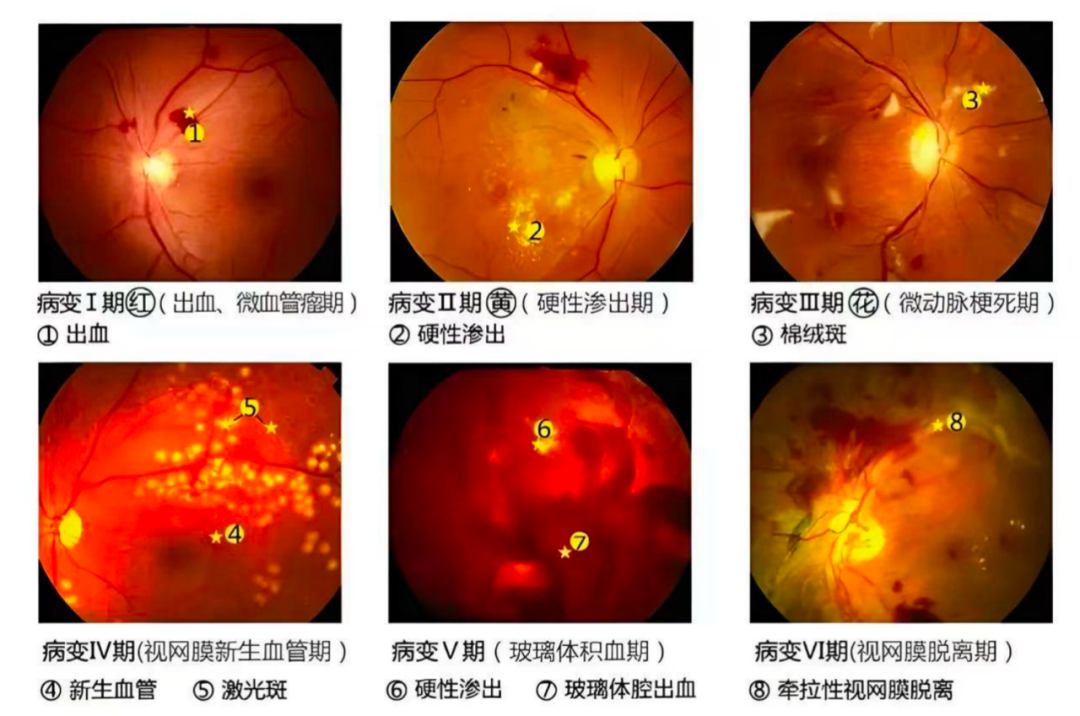 “睛”彩重阳 | 护眼小常识，快为父母收藏！ - 广州普瑞眼科医院
