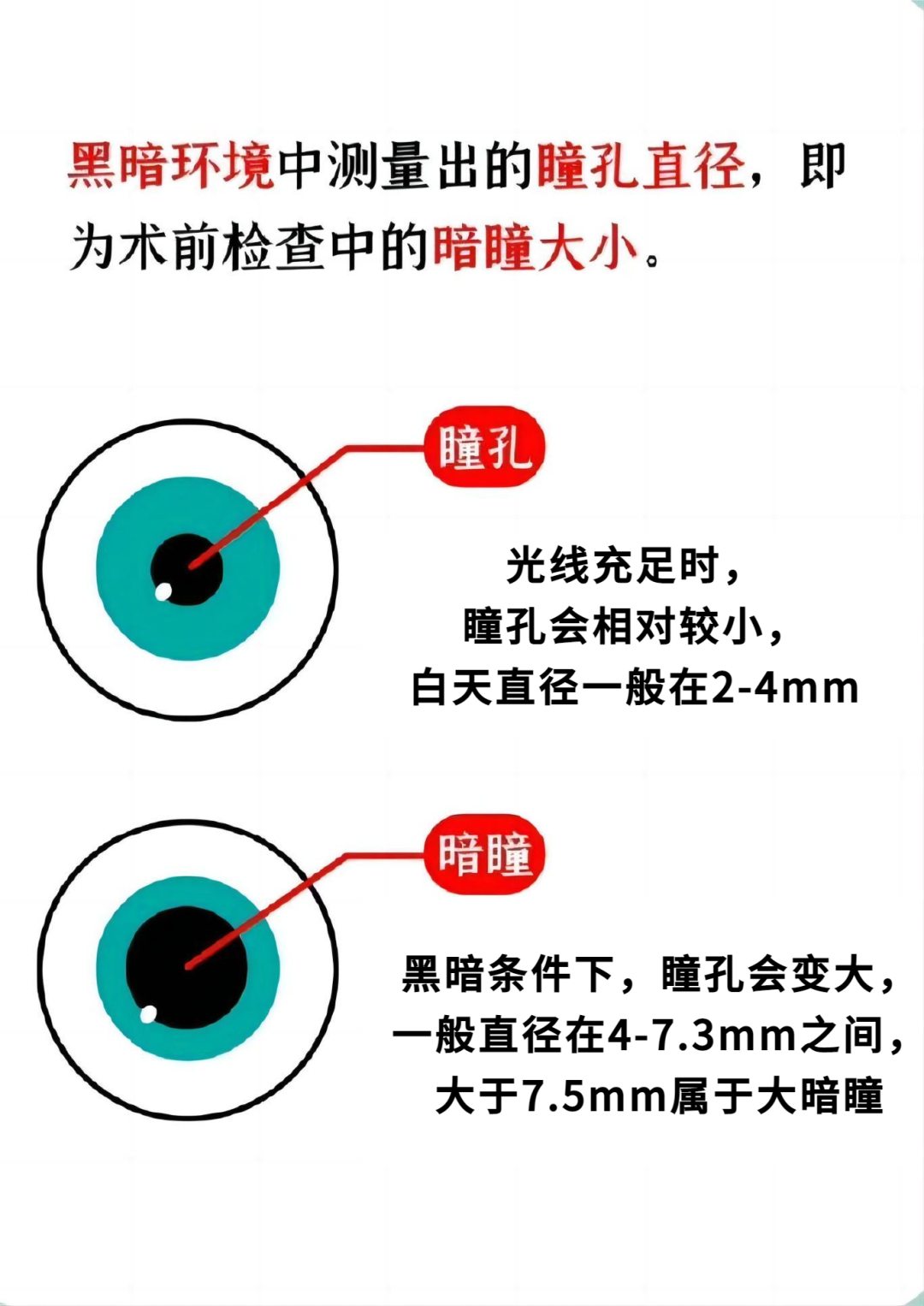 暗瞳大,一定做不了近视手术吗? - 广州普瑞眼科医院
