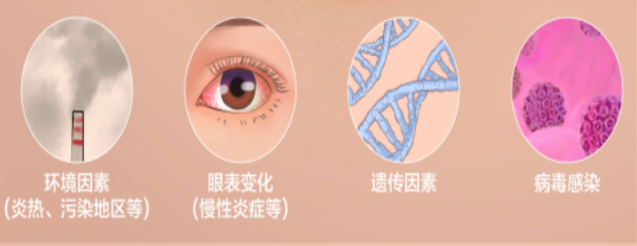 眼角有块膜状物,这是什么? - 广州普瑞眼科医院