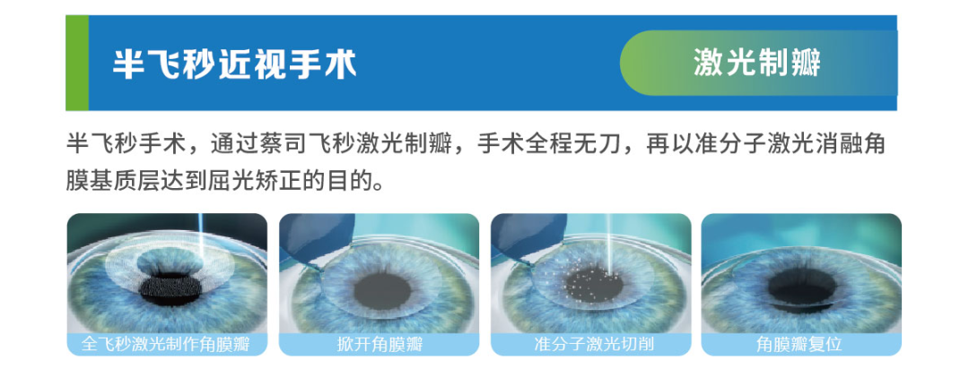做一次、管终身?近视手术有“保质期”吗? - 广州普瑞眼科医院