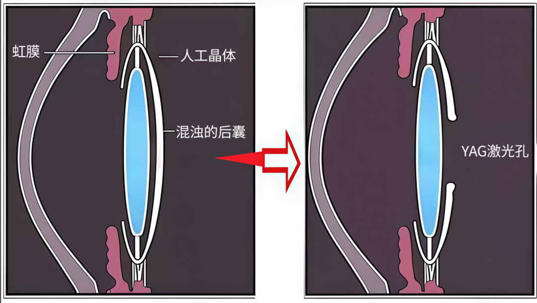 (已)修图.png
