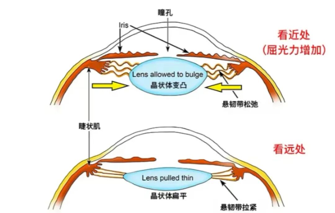别让看得“更清楚”伤了眼睛！ - 广州普瑞眼科医院