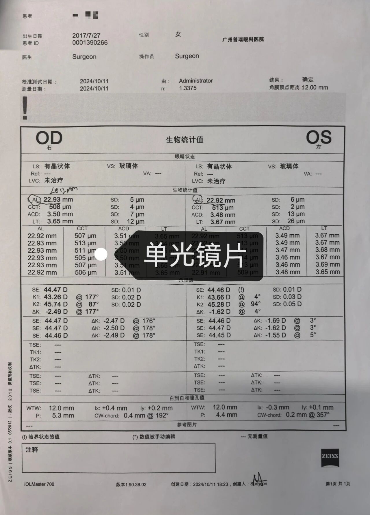 【真实案例】为什么配镜要选医院? - 广州普瑞眼科医院