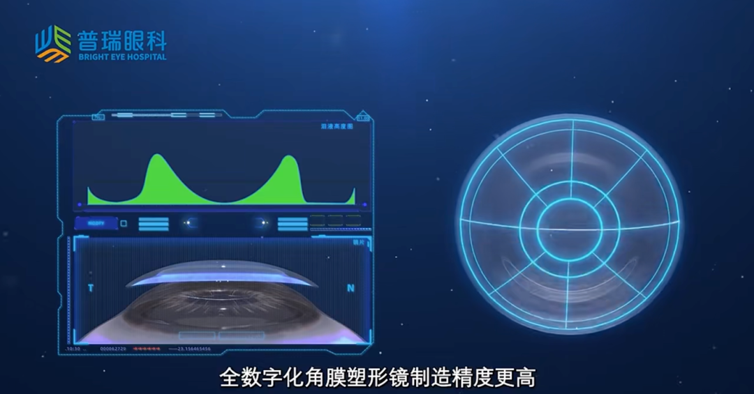 想配角膜塑形镜又不想花时间试戴?数字化角膜塑形镜了解一下? - 广州普瑞眼科医院