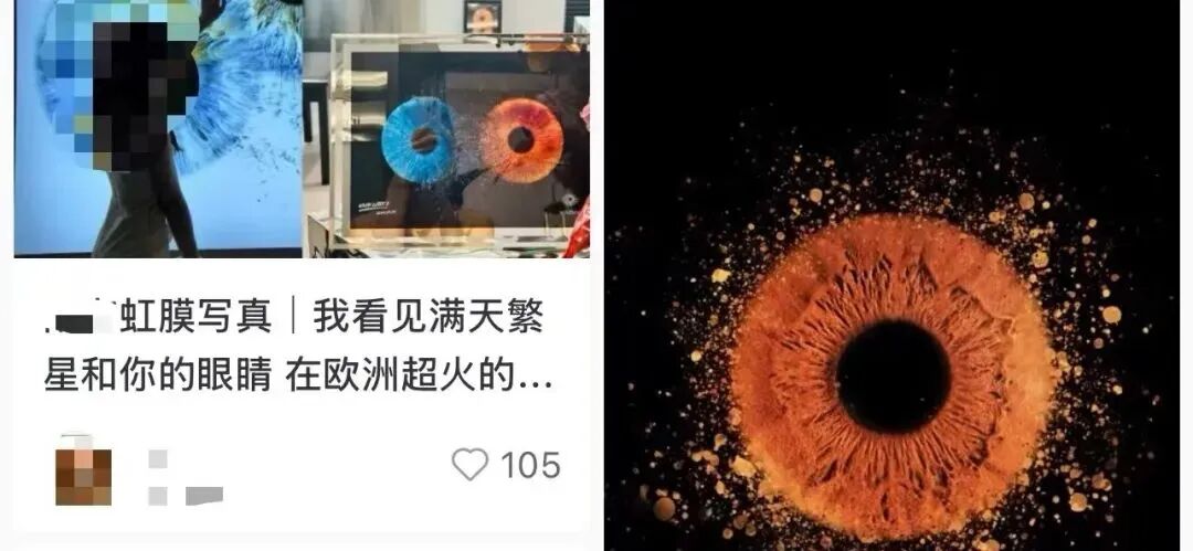 最近爆火的“虹膜写真”会伤害眼睛吗?广州普瑞眼科医院专家:安全,但不建议眼底病变,尤其是黄斑病变患者拍摄 - 广州普瑞眼科医院