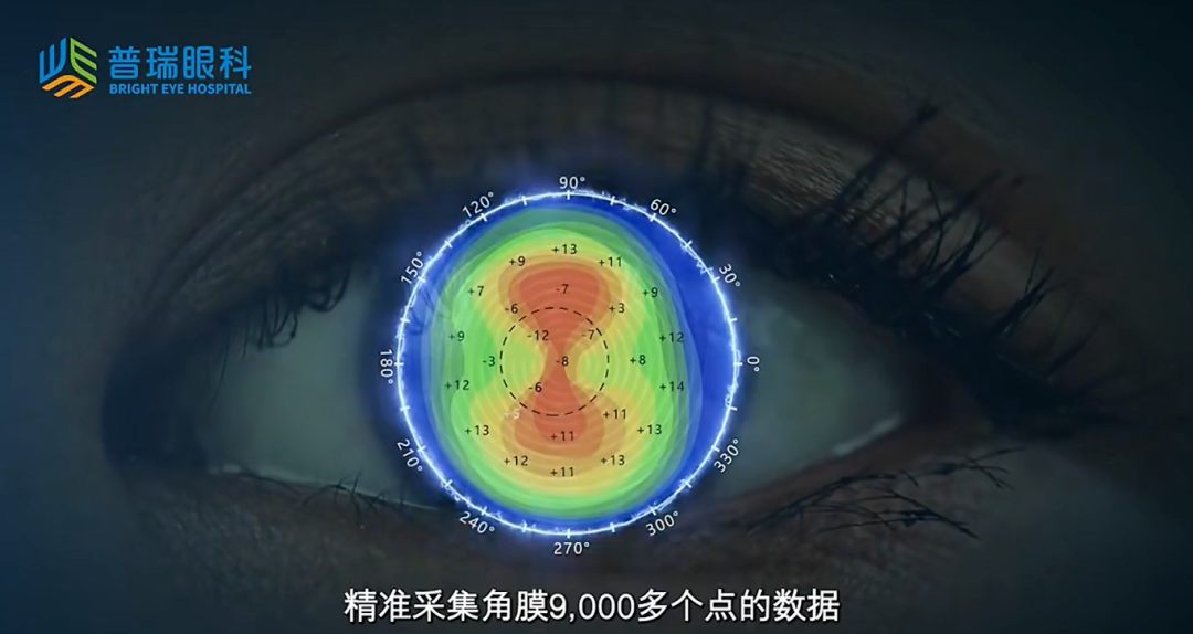 想配角膜塑形镜又不想花时间试戴?数字化角膜塑形镜了解一下? - 广州普瑞眼科医院