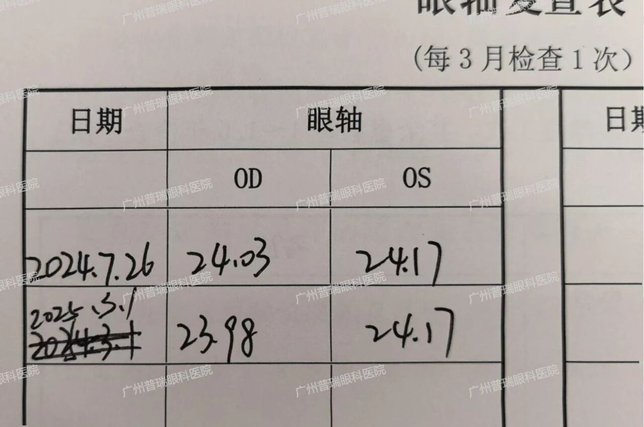 【真实案例】平光离焦镜是智商税吗？ - 广州普瑞眼科医院