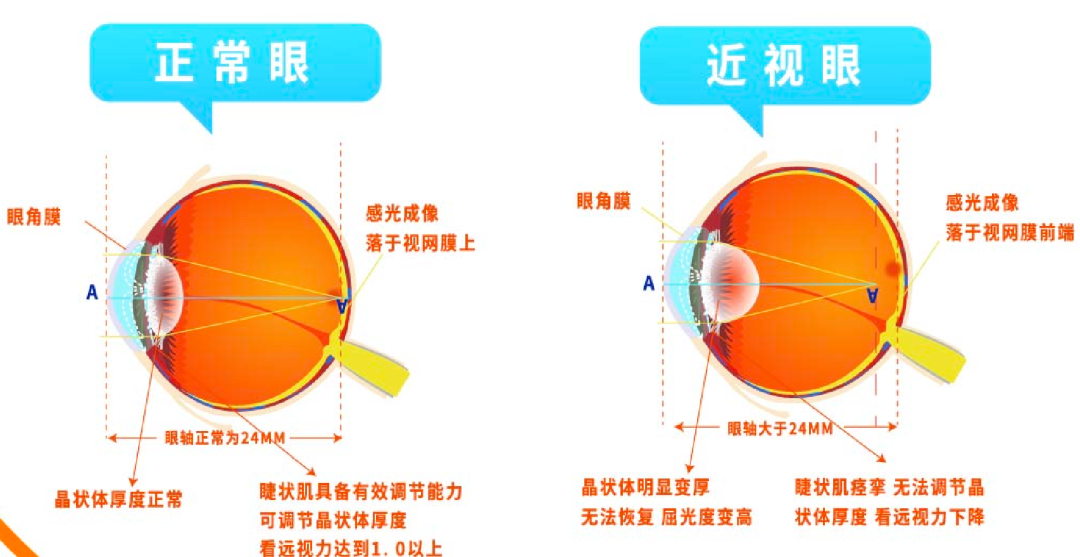 66爱眼日:公园里的科普馆开馆了 - 广州普瑞眼科医院