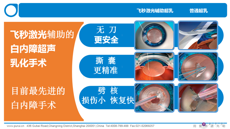 【直播回顾】沙翔垠教授公益直播全记录:35 年临床经验拆解白内障防治要点 - 广州普瑞眼科医院