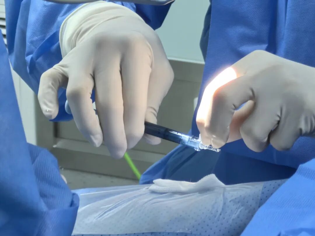 国内首例！2300度超高度近视患者龙晶®PR型晶体“双眼四襻同步植入”成功摘镜 - 广州普瑞眼科医院