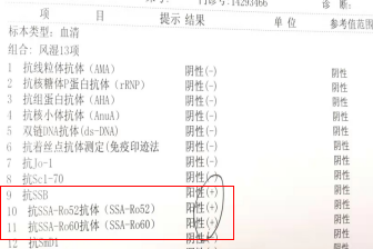 被 “干” 扰到崩溃?拒绝欲哭无泪 - 广州普瑞眼科医院