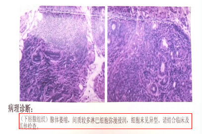 被 “干” 扰到崩溃?拒绝欲哭无泪 - 广州普瑞眼科医院