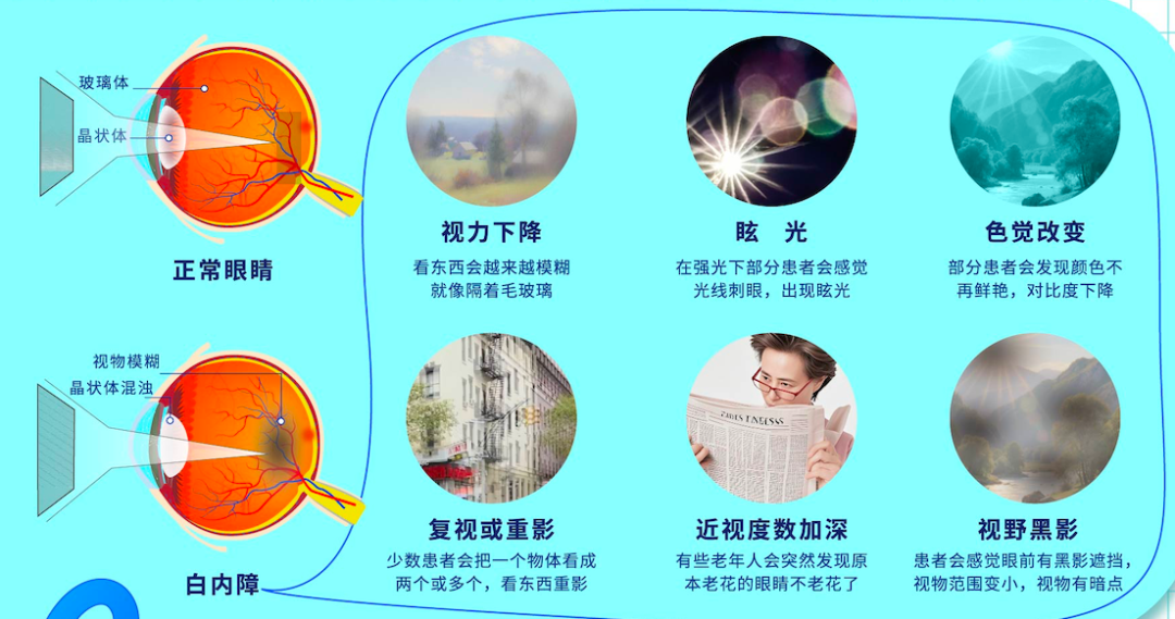 66爱眼日:公园里的科普馆开馆了 - 广州普瑞眼科医院