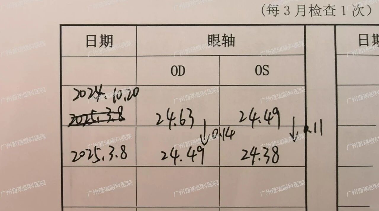 【真实案例】平光离焦镜是智商税吗？ - 广州普瑞眼科医院