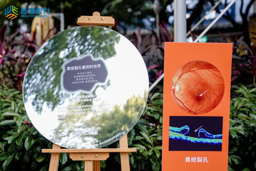 广州普瑞眼科医院#照镜子识眼病眼 眼健康科普艺术展活动圆满开展 - 广州普瑞眼科医院