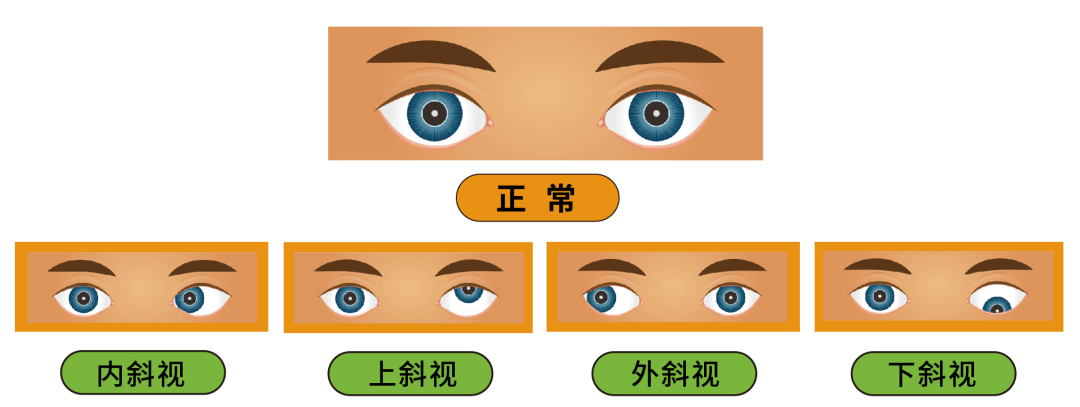 「视」关重大！这项视觉训练，同步锻炼大脑与双眼 - 广州普瑞眼科医院