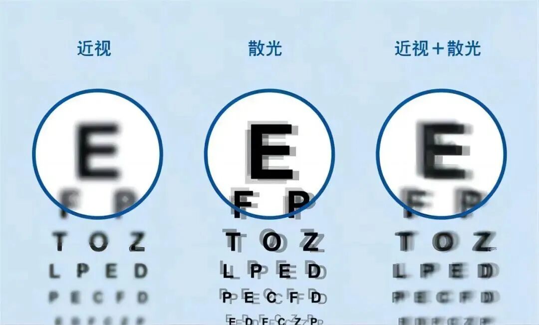 三维一体近视管理|除了近视,这个问题也让无数孩子戴上眼镜 - 广州普瑞眼科医院