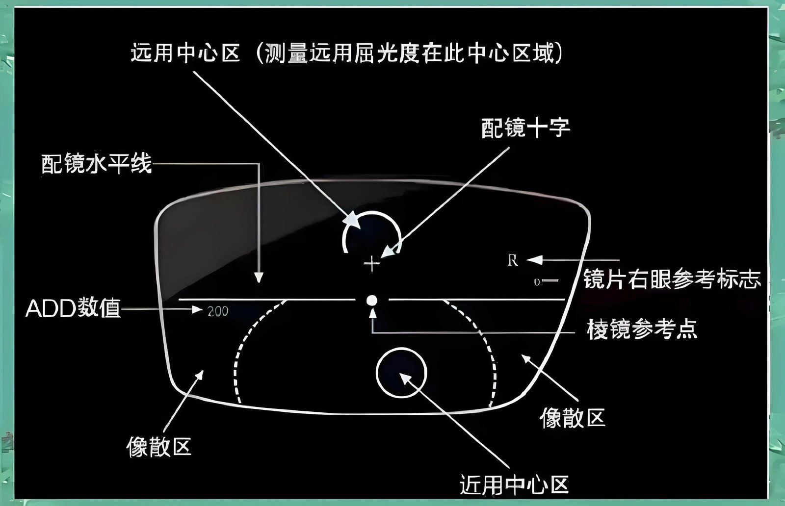 【视光案例】戴渐进镜看近还模糊？ - 广州普瑞眼科医院