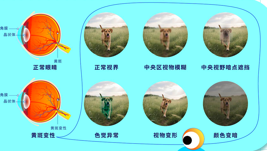 66爱眼日:公园里的科普馆开馆了 - 广州普瑞眼科医院