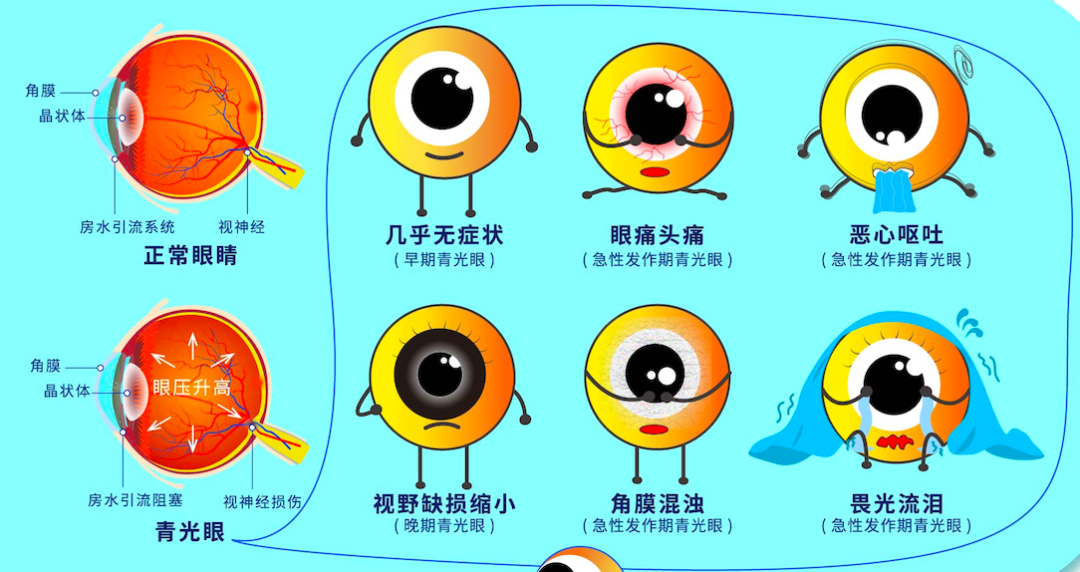 66爱眼日:公园里的科普馆开馆了 - 广州普瑞眼科医院
