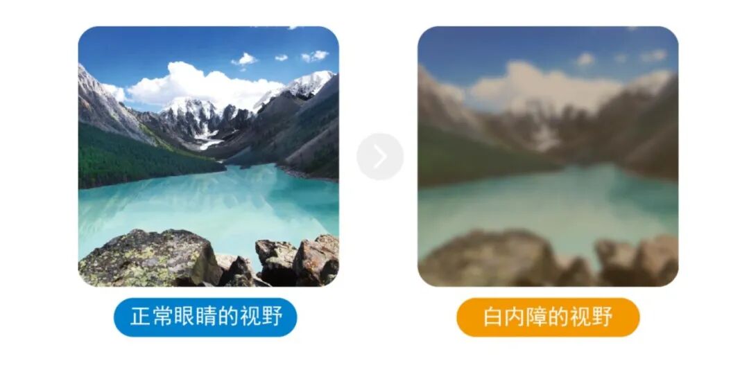 【白内障专科】广州医科大学附属第二医院沙翔垠教授、广州市第一人民医院眼科原主任杨为中教授、广东省人民医院费文雷教授 - 广州普瑞眼科医院