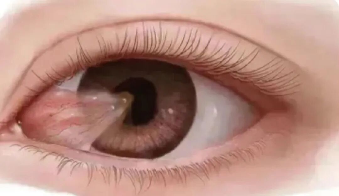 【角膜及眼表疾病科】角膜及眼表疾病科副主任戴慧 - 广州普瑞眼科医院